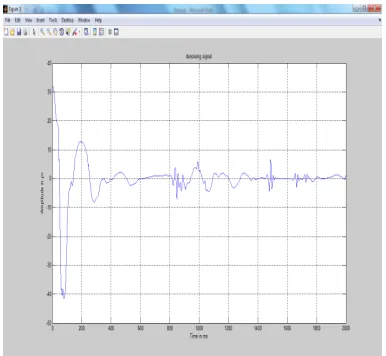 Figure  7  Identification Of EOG Artifact Zones 