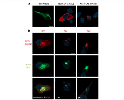 Fig. 4 NEFH mutation destabilised NEFL filamentous network in vitro.form aggresome containing NEFL, p62/SQSTM1 and LC3b.10WT or untagged NEFH-CAE (c3008_3010delGA mutation)