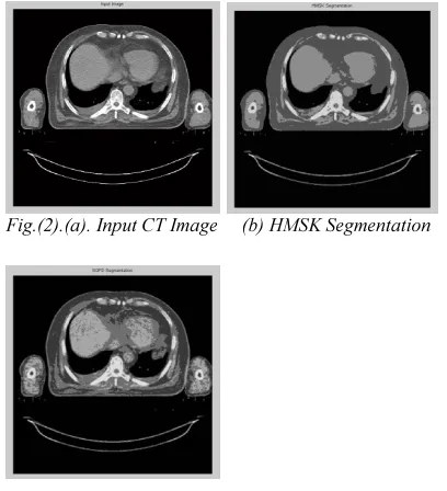 Fig.(2).(a). Input CT Image     (b) HMSK Segmentation                      many segmentation algorithms