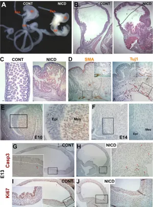 Fig. 4. Gain of Notch function causes severe gut