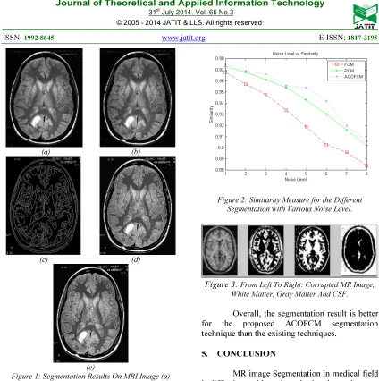 Figure 1: ACO (d) Segmented MRI Brain Image Using PCM (e) Original MRI Image (b) Segmented MRI Brain Image Using FCM(c) Segmented MRI Brain Image Using Segmentation Results On MRI Image (a) Segmented MRI Brain Image Using ACOFCM 