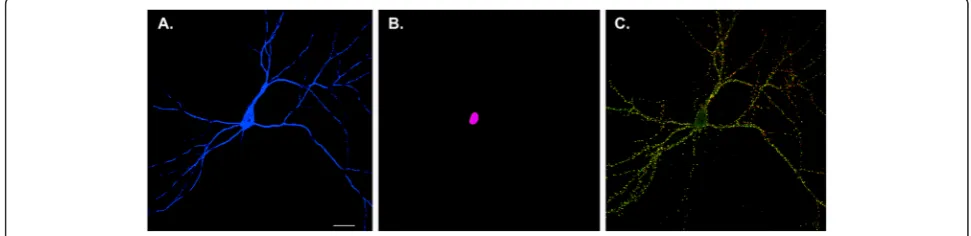 Fig. 2. Neuron versus synaptic maps of memory. The Golgi method used by Ramon y Cajal at the turn of the 19th century revealed that thebrain consisted of individual nerve cells, leading to the formulation of the neuron doctrine