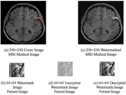 Figure 11: Discrete Wavelet Transform of Level -2 using  ‘bd2’ mother wavelet (a) Original Brain fMRI Medical   Image (b) its 2D DWT using db2 at level-2 