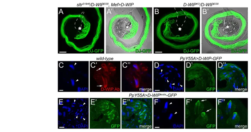 Fig. 2. D-WIP mediates spermatid release via a testis-specific isoform. ((arrows). (D-Dpatterns in mature cysts positioned at the testis basal end