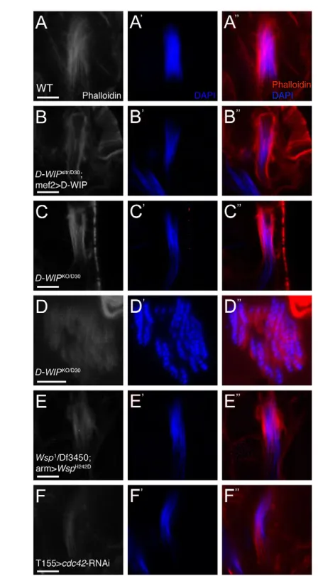 Fig. 5. D-WIPdriver was used to avoid obscuring ‘debris’ associated with GAL4. D-Dof isolated cyst whole-mounts