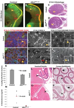 Fig. 5. Mesonephric-derived testicular cells are reducedin Leydig cells. At E18.5, controls (E) contained more Leydigcells (yellow arrowheads) versus year old males