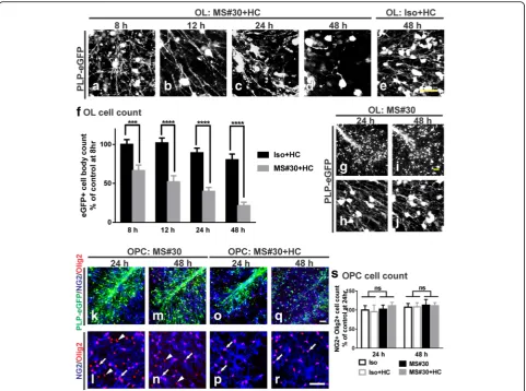 Fig. 2 MS#30 plus human complement (HC) causes robust loss of mature oligodendrocytes but not progenitors
