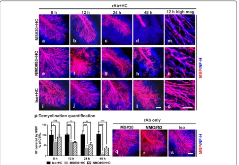 Fig. 3 MS#30 and NMO rAb #53 (NMO#53) induce demyelination at different rates. Cerebellar slices were treated with MS#30 + HC (a–d, m), orNMO#53 + HC (e–h, n), or Iso + HC (i–l, o)