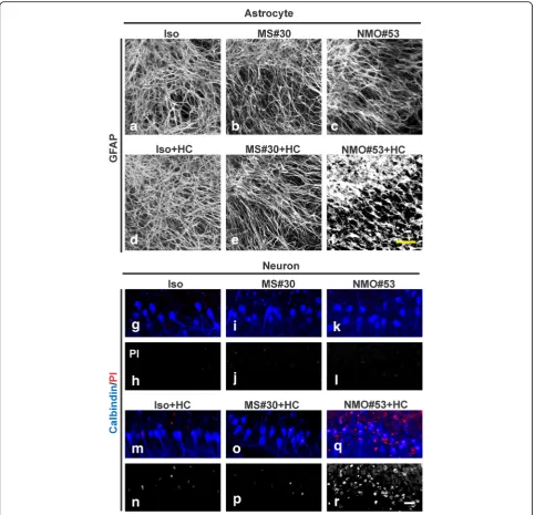 Fig. 4 MS#30 and NMO#53 have distinct effects on astrocytes and neurons. Immunostaining of astrocytes (treated with rAbs with or without HC for 48 h