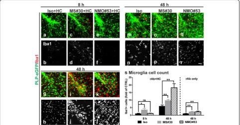 Fig. 5 Activation of microglia in MS#30 and NMO#53 treated slices. Cerebellar slices treated with rAbs with (at indicated time points and then stained with microglia marker Iba1 (normalized to control (using multiple unpaired Studenta–l) or without (m–r) H