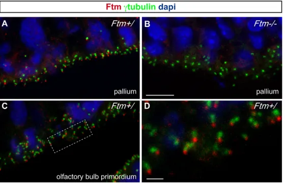 Fig. 1. Ftm localizes at the cilium base in the