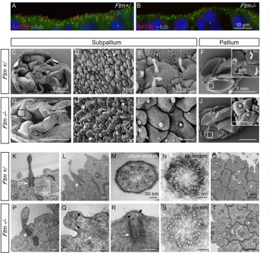 Fig. 2. Impaired ciliogenesis in the–/– 