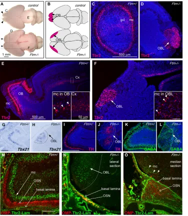Fig. 3. The Ftm–/– telencephalon