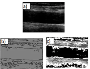 Fig.4.A) Original Image Of Longitudinal Sections Of 