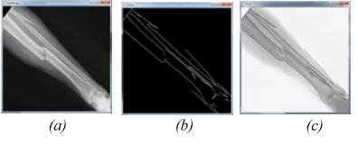 Figure 3 (a) Input Image (b) Output Image with 