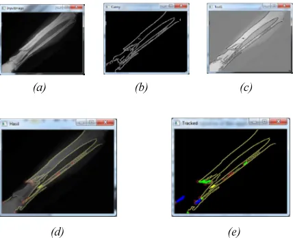 Figure 5 (a) Input Image (b) Output Image with 