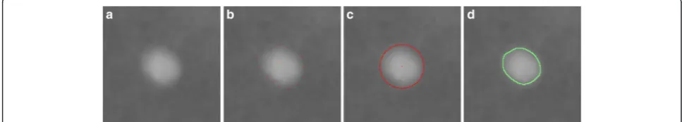 Fig. 3 An example of the segmentation steps. a An image patch showing a subtle microcalcification, b 16 edge points determined by thealgorithm, c fitting edge points with a circle, and d the result of active contour segmentation