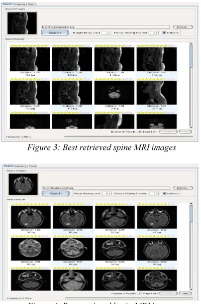 Figure 3: Best retrieved spine MRI images 