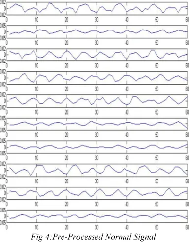 Fig 4:Pre-Processed Normal Signal 