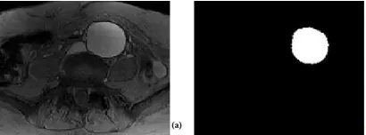 Figure 1. (A) Amplitude Image As An Input, (B) The Segmentation Result (Image Of The Aorta) 