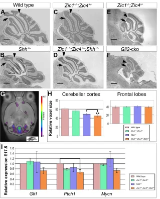Fig. 5. Zic gene interaction with the Shhpathway controls cerebellar size, but notsections through the cerebellar vermis of P20 mice.Black arrowheads and arrows (A-F) indicate theprimary and preculminate fissures, respectively.Compared with wild type (A),n