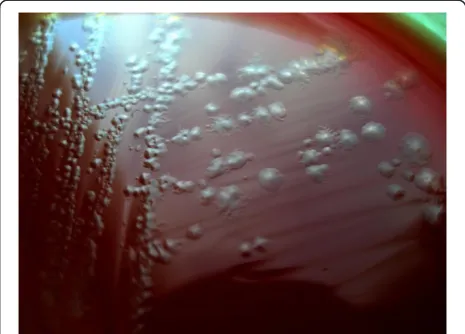 Figure 1 C. difficile colony morphology.