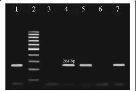Table 1 Primers for identification of C. difficile tcdA, tcdB, cdtA and cdtB genes