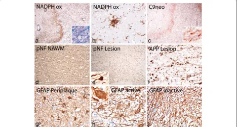 Fig. 2 Demyelination and gliosis in active white matter lesions: a: Activity at the edge of the lesion is associated with densely packed activatedmacrophages and microglia, expressing NADPH oxidase; profound activation of microglia is also seen in the peri