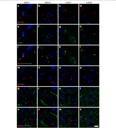 Fig. 6 Staining for phosphorylated alpha-synuclein is specific. Confocal imaging of brain sections of Tg(SNCA)1Nbm/J mice injected with brainextracts from MSA or probable iLBD cases shows that at 9 months post injection staining with the EP1536Y antibody f