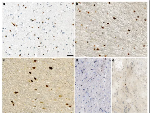Fig. 1 Brains of MSA and probable iLBD cases contain pathogenic alpha-synuclein. Immunohistochemical staining with an antibody againstphosphorylated alpha-synuclein (81A) revealed glial cytoplasmic inclusions in cortical brain tissue sections from the MSA1