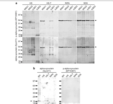 Fig. 2 Biochemical analysis of alpha-synuclein in patient brains. Biochemical analysis of alpha-synuclein in patient brains shows thatSDS-extractable phosphorylated alpha-synuclein was only observed in samples from patient brains a but not in a control bra