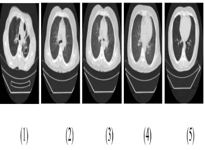 Figure 4: CT Images for our proposed method 
