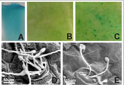 Figure 2 Inoculations of GUS-RNAi tobacco lines with GUS expressingexpression level. (D, E) After GUS assay, leaf surfaces (presented in B and C) were observed under a scanning electron microscope in order topresented GUS expression