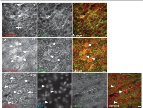 Fig. 2 Localization of C9ORF72 during developmentnuclei (DAPI, arrowheads) Scale bar: 10bneuropil ( in vivo