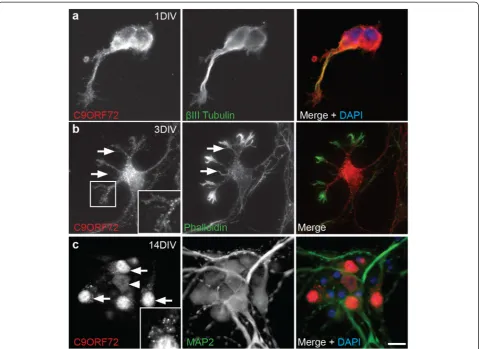 Fig. 6 Localization of C9ORF72 over developmentsomal localization of this protein. Inset (of other neurons ( in vitro