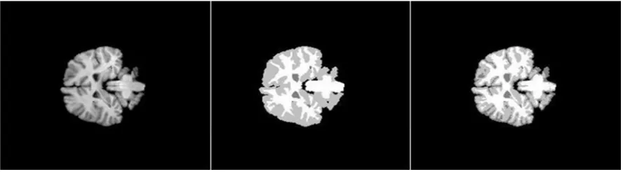 Fig 6. Tissue removal steps from left to right, original volume 16_3 (slice #22), ground truth, region of interest