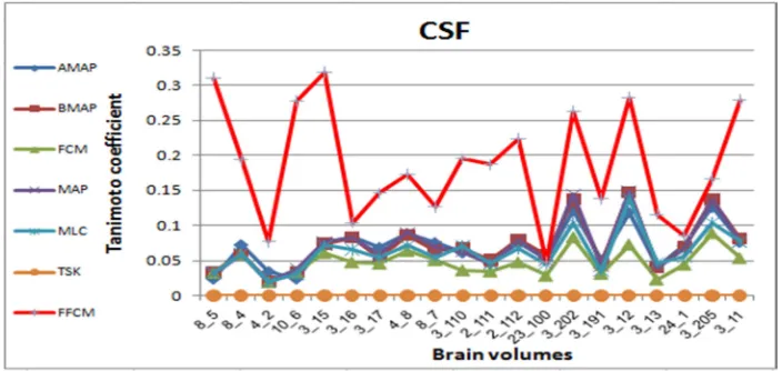 Fig 7b. From Left To Right, Original Volume (8_4), Ground Truth Volume (8_4), And Segmented Volume (8_4) By FFCM