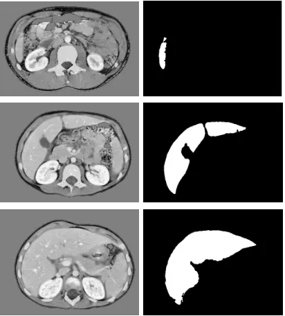 Figure 4 shows a set of sample slices from various abdominal levels. 