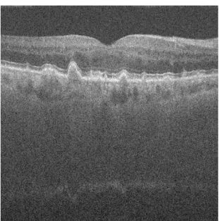 Figure 9: Original SD-OCT Image  