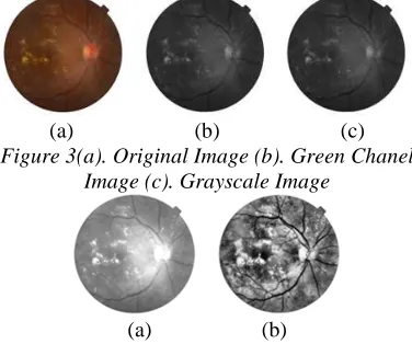 Figure 3(a). Original Image (b). Green Chanel (a)                      (b)                      (c) Image (c)