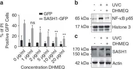 Figure 6SASH1-induced apoptosis is dependent on the NF-experiments. ((30 mJ/cmwithout DHMEQ (10(transfection and were live stained with PI (dead marker) and Hoechst (nuclearmarker)