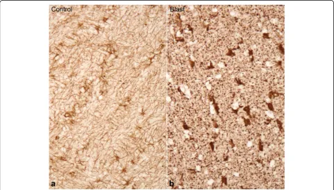 Table 2 Astrocyte density, (number per mm2) ± SD in thedentate area