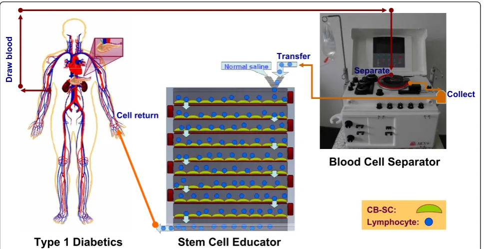 Figure 1 Overview of Stem Cell Educator therapyEducator (bottom center) to form a closed system