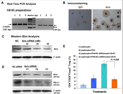 Figure 4 Characterization of Aire in CB-SCpresence of PHA and Aire siRNA (50 nM)-treated CB-SCs