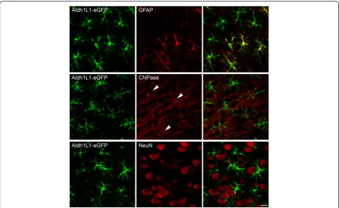 Fig. 1 ALDH1L1-eGFP expression is specific for astrocytes. Top panels: Double-labeling studies showing colocalization of ALDH1L1-eGFP (and the astrocytic marker GFAP (green)red)