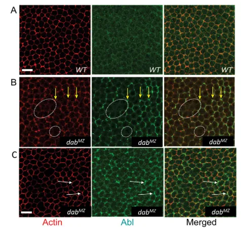 Fig. 8. Subcellular localization of Abl is altered in Dabphalloidin (F-actin) and anti-Abl