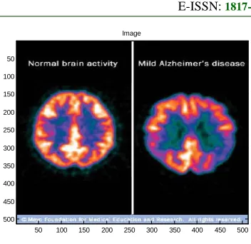 Figure 6: XYZ  image 