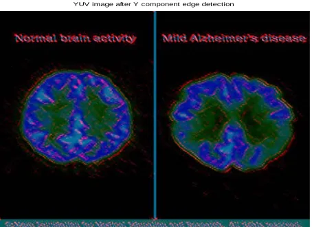 Figure 8: YCbCr image 