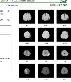 Figure 2: Sample MRI images used in the study 