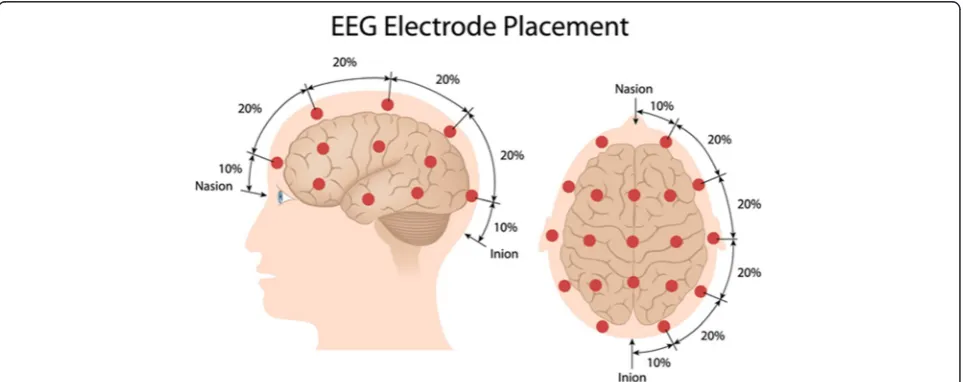 Fig. 1 Processing of EEG signals